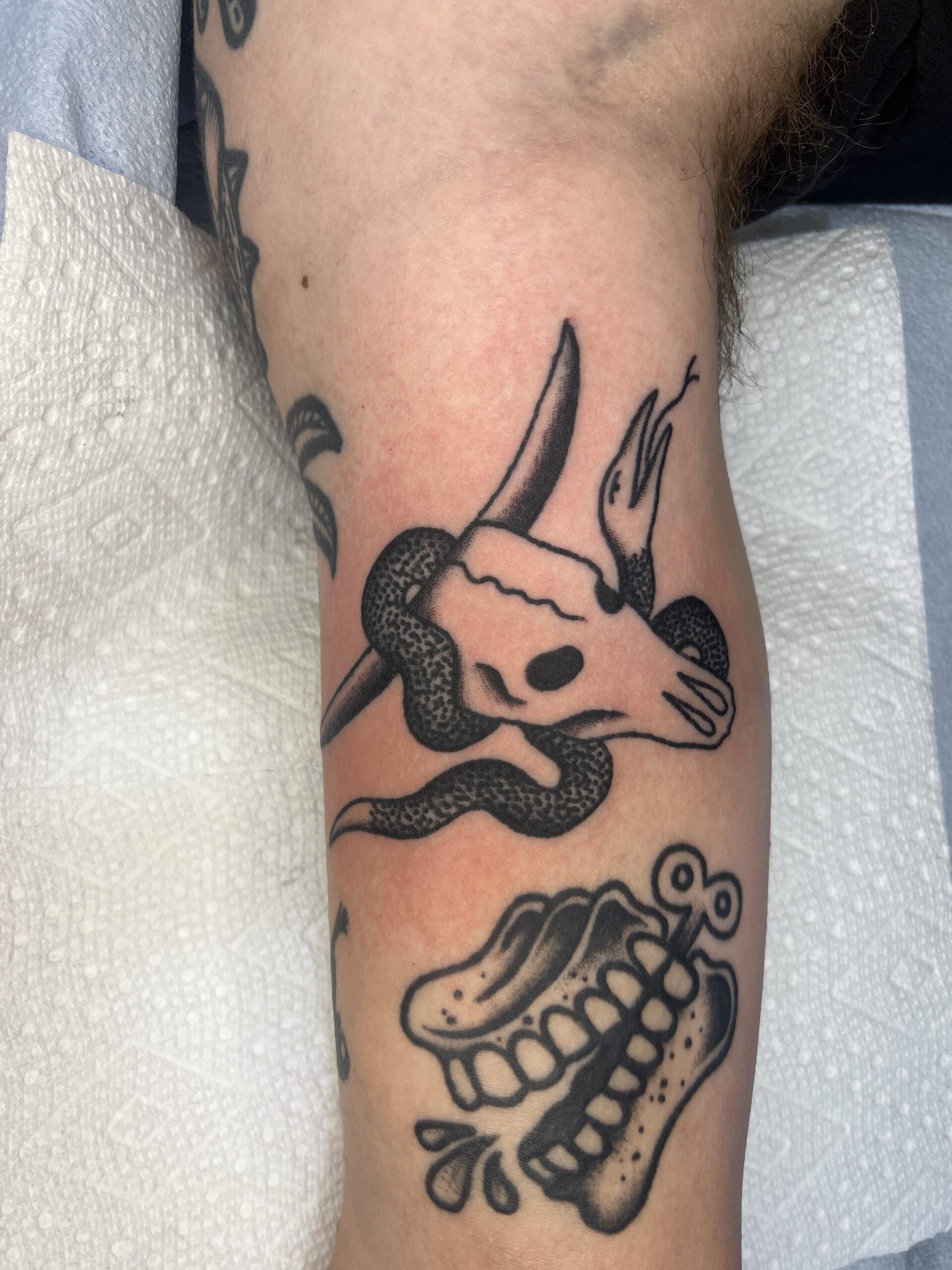Bold Hand-Poke Skull and Teeth Tattoo