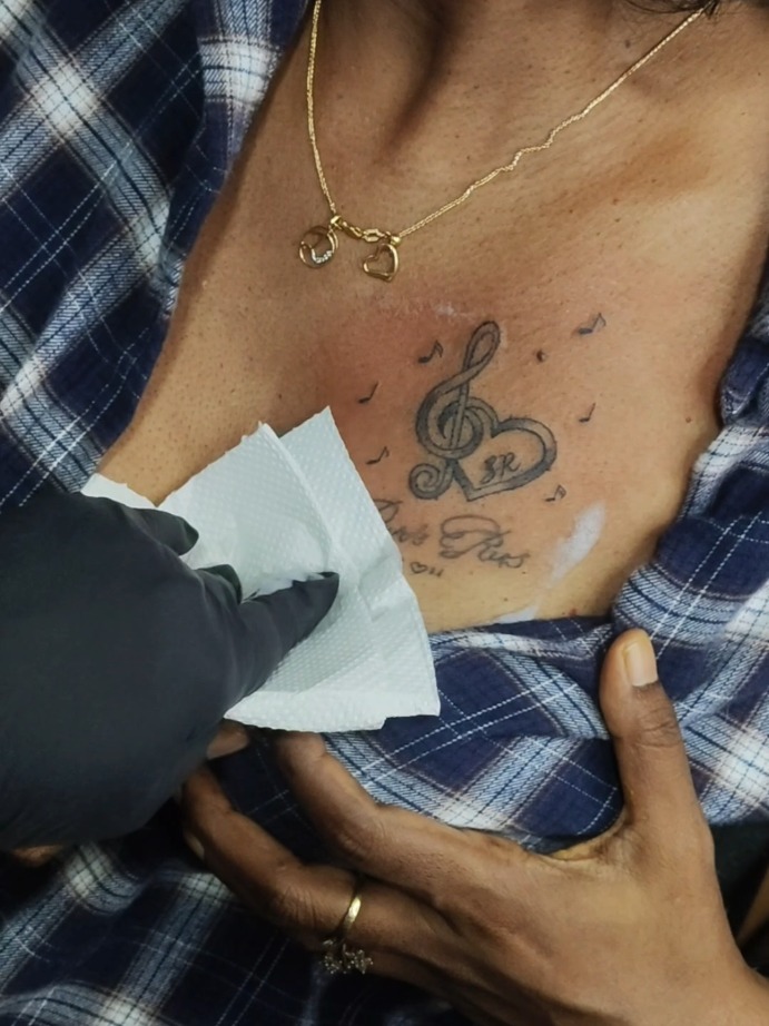 Musical Clef Chest Tattoo Process